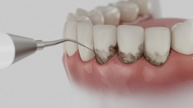 Reliable Teeth Cleaning And Checkup contractor in Warren County County, MS by Dentist Open Now